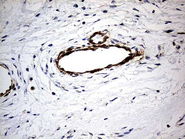 KIF6 Antibody in Immunohistochemistry (Paraffin) (IHC (P))