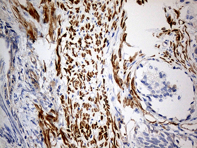 KIF6 Antibody in Immunohistochemistry (Paraffin) (IHC (P))