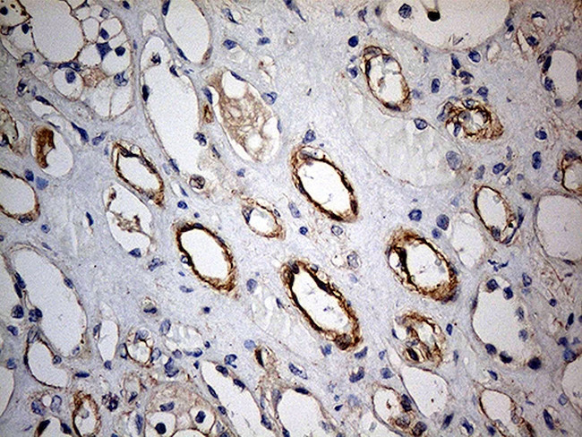 KIF6 Antibody in Immunohistochemistry (Paraffin) (IHC (P))