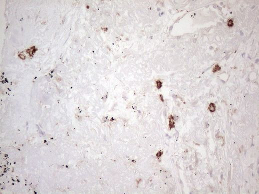 KIT Antibody in Immunohistochemistry (Paraffin) (IHC (P))