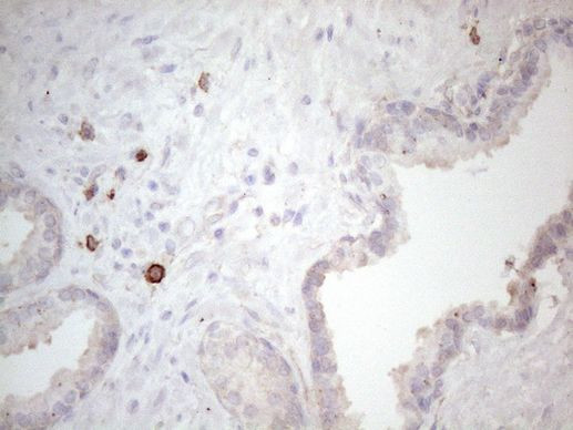 KIT Antibody in Immunohistochemistry (Paraffin) (IHC (P))