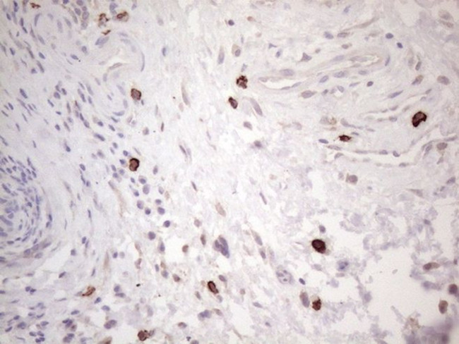 KIT Antibody in Immunohistochemistry (Paraffin) (IHC (P))