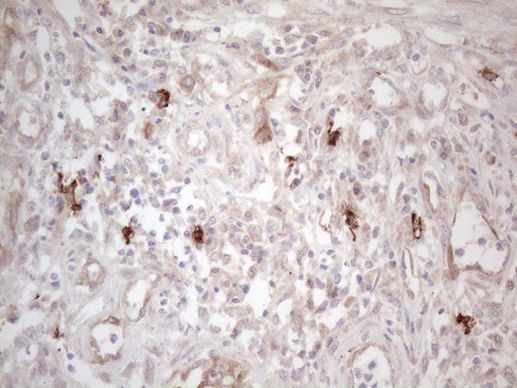 KIT Antibody in Immunohistochemistry (Paraffin) (IHC (P))