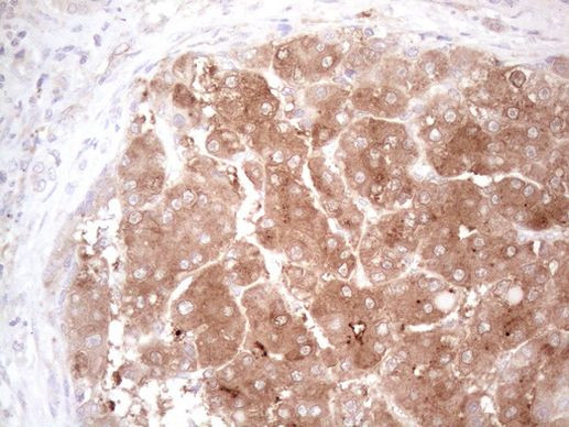 KIT Antibody in Immunohistochemistry (Paraffin) (IHC (P))