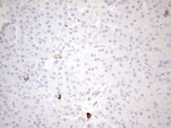 KIT Antibody in Immunohistochemistry (Paraffin) (IHC (P))