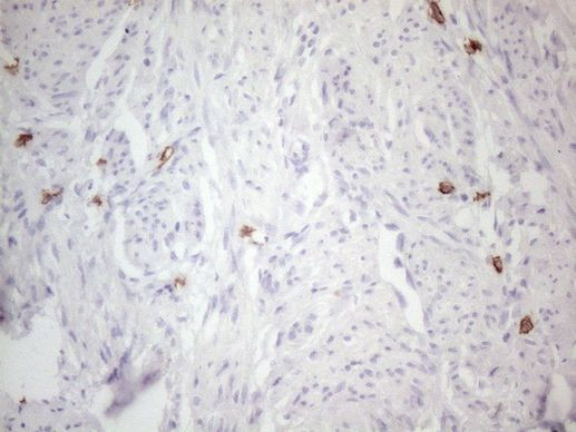 KIT Antibody in Immunohistochemistry (Paraffin) (IHC (P))