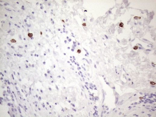 KIT Antibody in Immunohistochemistry (Paraffin) (IHC (P))