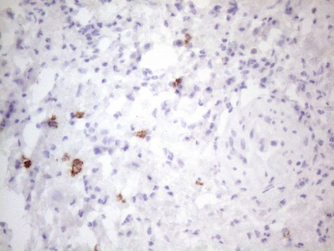 KIT Antibody in Immunohistochemistry (Paraffin) (IHC (P))