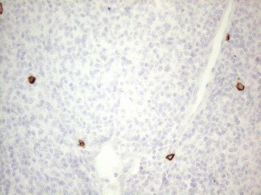 KIT Antibody in Immunohistochemistry (Paraffin) (IHC (P))