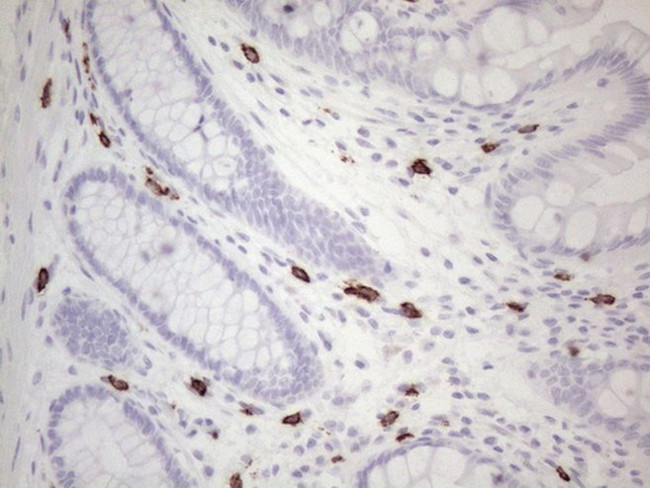 KIT Antibody in Immunohistochemistry (Paraffin) (IHC (P))