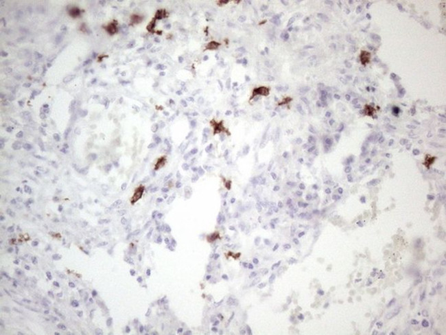 KIT Antibody in Immunohistochemistry (Paraffin) (IHC (P))