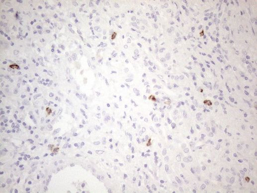 KIT Antibody in Immunohistochemistry (Paraffin) (IHC (P))