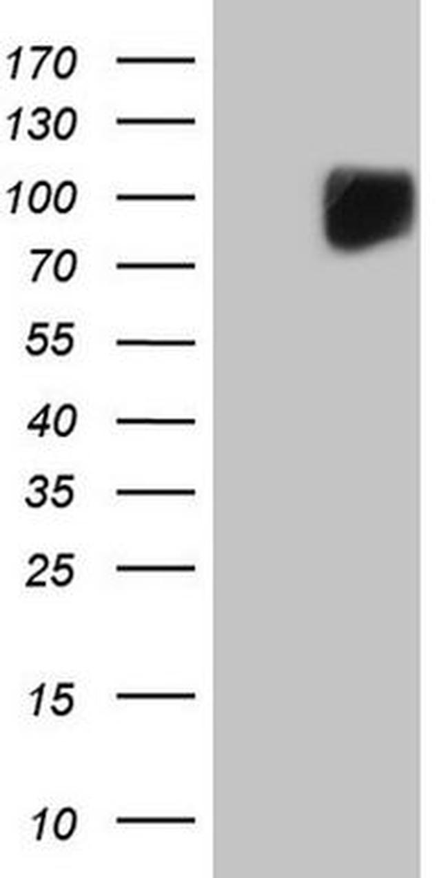 KIT Antibody in Western Blot (WB)