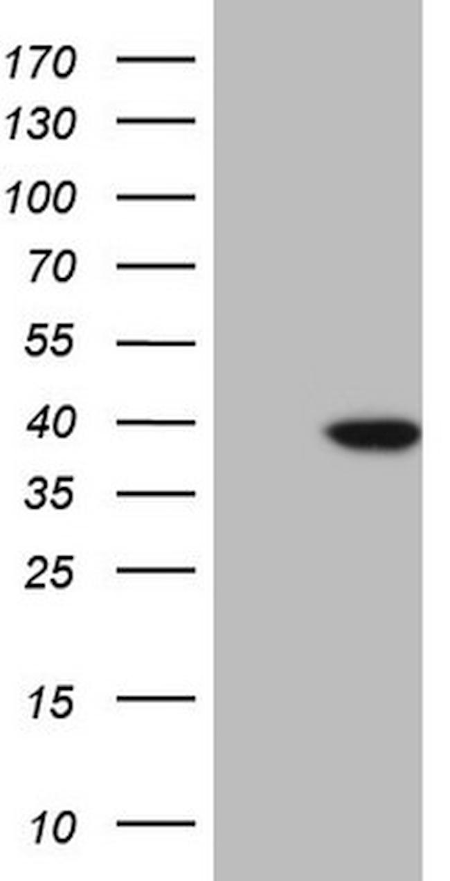 KLF2 Antibody in Western Blot (WB)