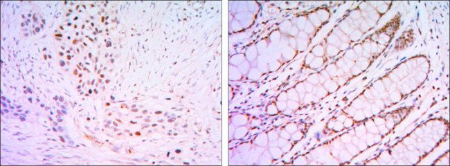 KLF4 Antibody in Immunohistochemistry (Paraffin) (IHC (P))