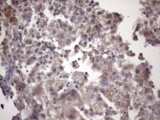 KLF9 Antibody in Immunohistochemistry (Paraffin) (IHC (P))