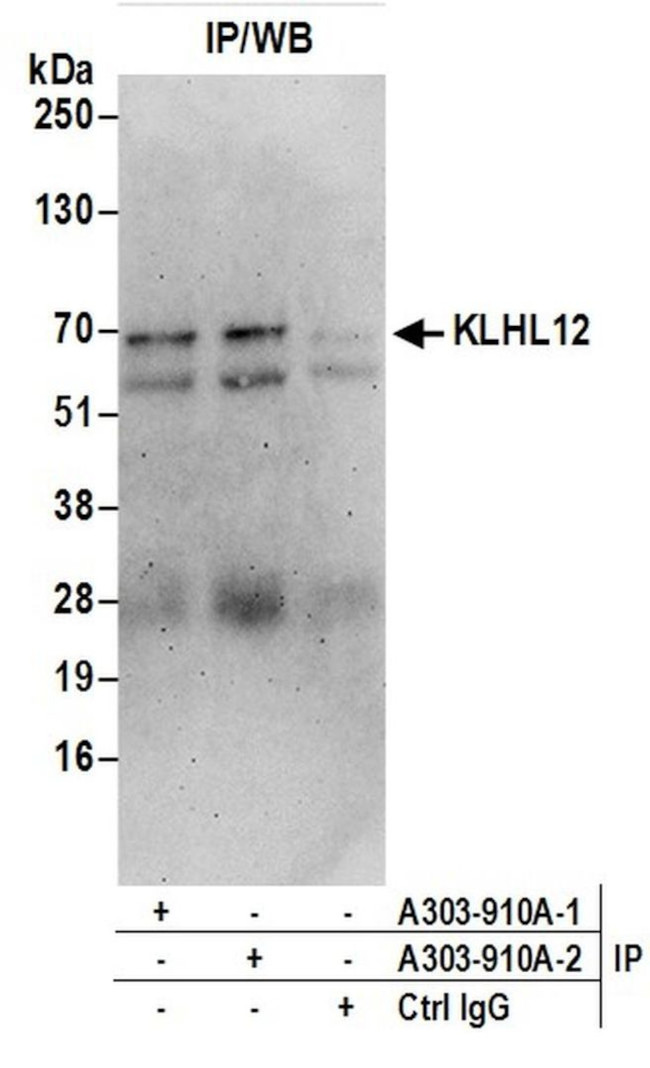 KLHL12 Antibody in Immunoprecipitation (IP)