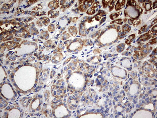 KLHL12 Antibody in Immunohistochemistry (Paraffin) (IHC (P))