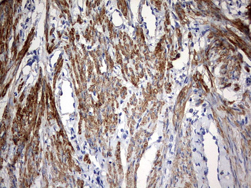 KLHL12 Antibody in Immunohistochemistry (Paraffin) (IHC (P))