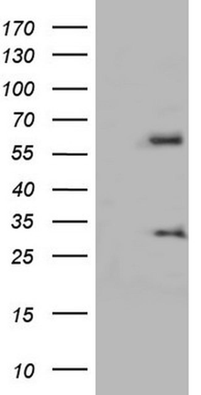 KLHL12 Antibody in Western Blot (WB)