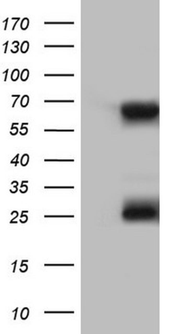 KLHL12 Antibody in Western Blot (WB)