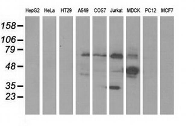 KLHL2 Antibody in Western Blot (WB)