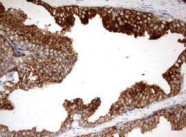 KLK2 Antibody in Immunohistochemistry (Paraffin) (IHC (P))