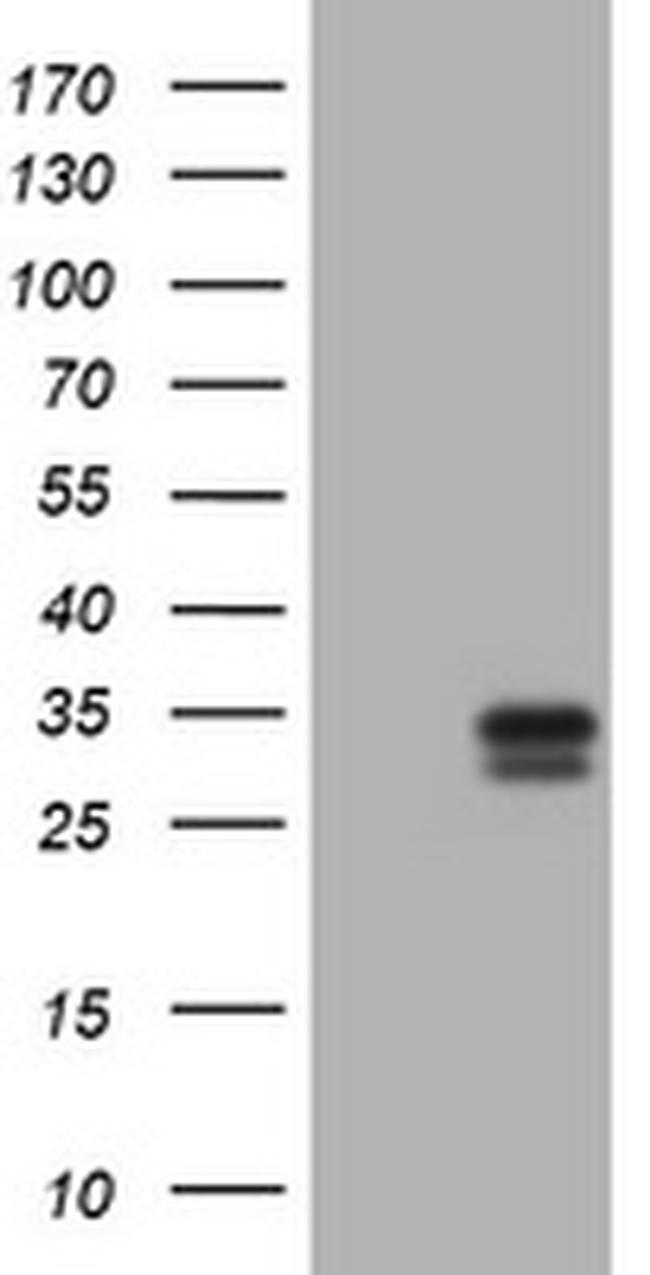 KLK2 Antibody in Western Blot (WB)