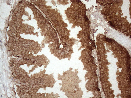 KLK3 Antibody in Immunohistochemistry (Paraffin) (IHC (P))