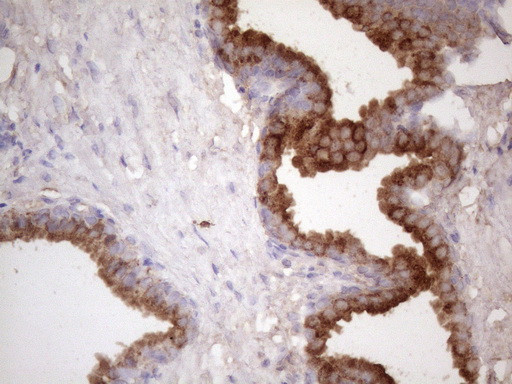 KLK3 Antibody in Immunohistochemistry (Paraffin) (IHC (P))