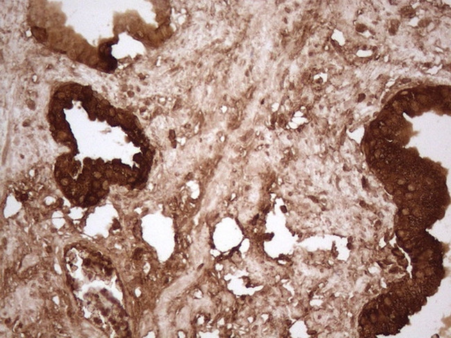 KLK3 Antibody in Immunohistochemistry (Paraffin) (IHC (P))