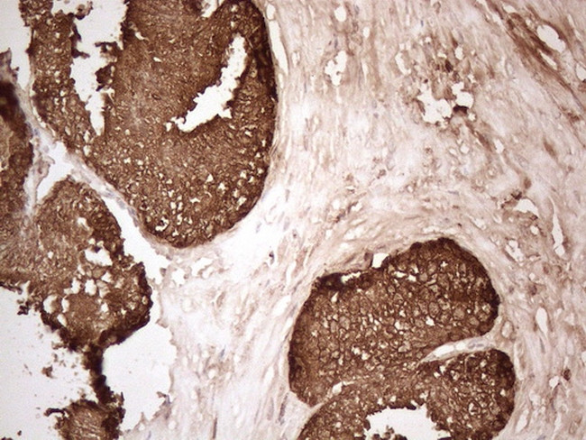 KLK3 Antibody in Immunohistochemistry (Paraffin) (IHC (P))