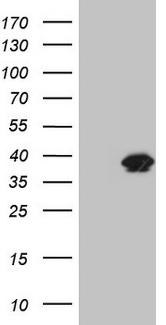 KLK3 Antibody in Western Blot (WB)