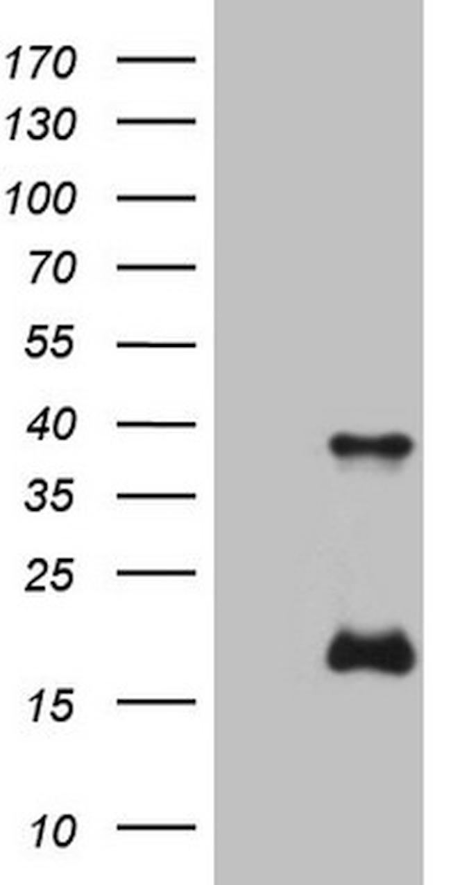 KLK3 Antibody in Western Blot (WB)