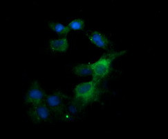 KLK8 Antibody in Immunocytochemistry (ICC/IF)