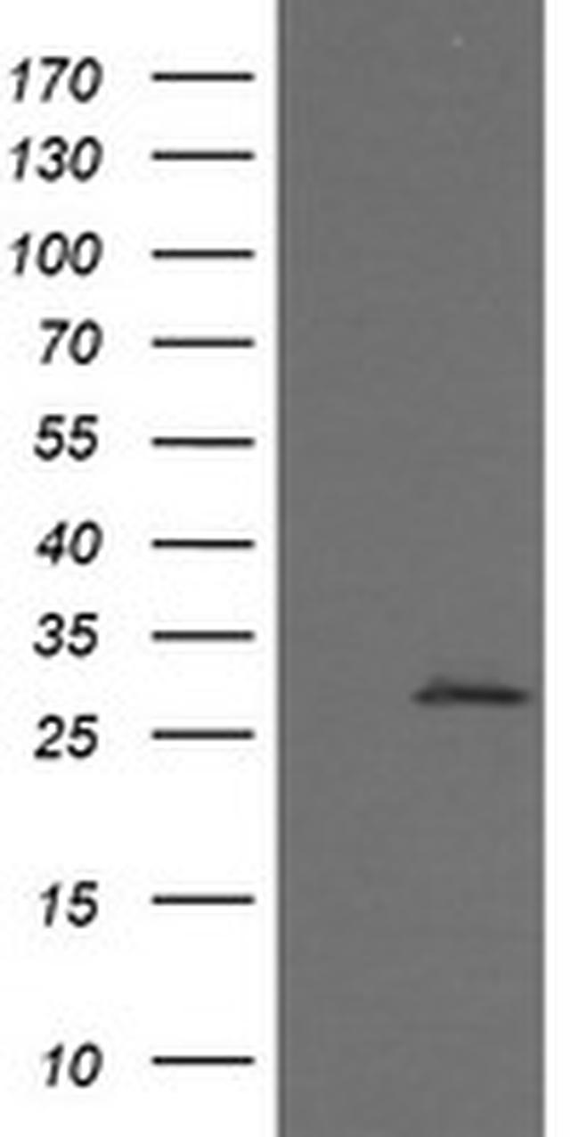 KLK8 Antibody in Western Blot (WB)