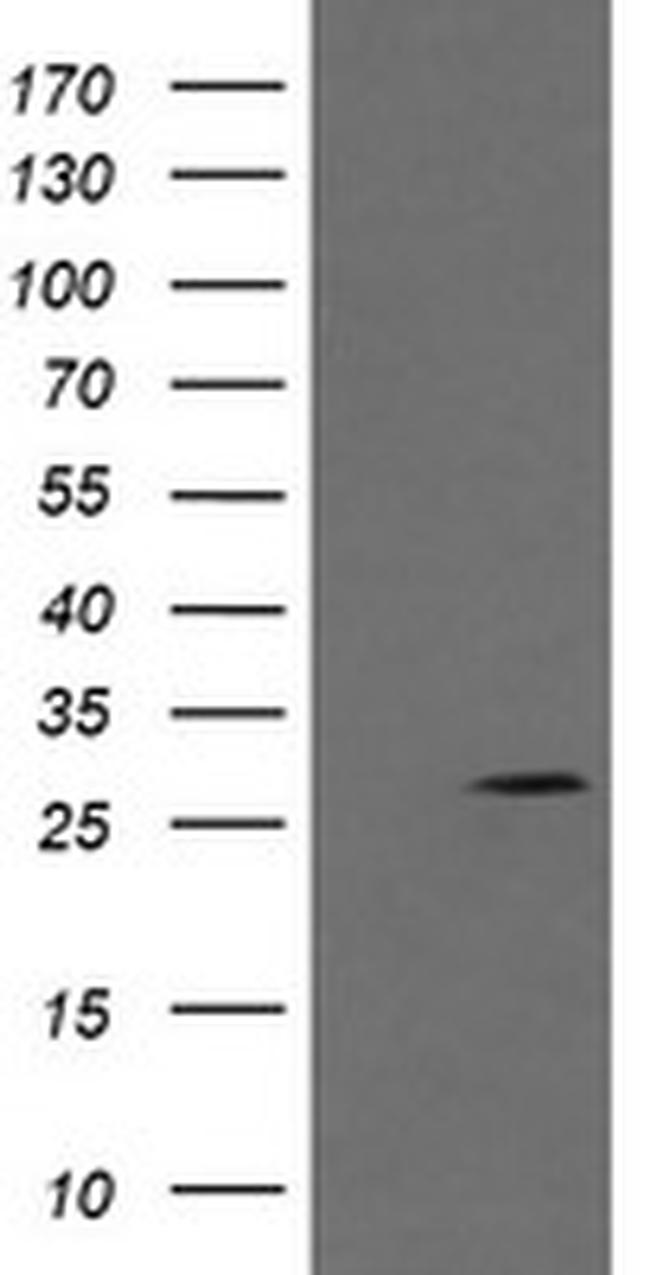 KLK8 Antibody in Western Blot (WB)