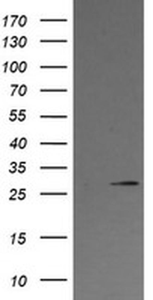 KLK8 Antibody in Western Blot (WB)