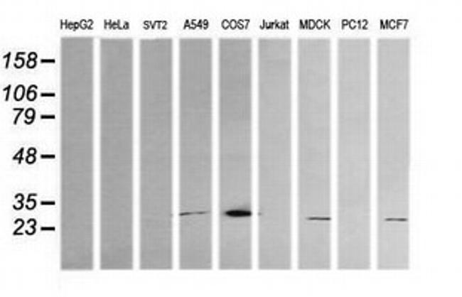 KLK8 Antibody in Western Blot (WB)