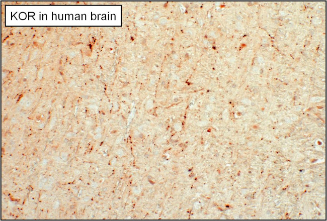 OPRK1 Antibody in Immunohistochemistry (Paraffin) (IHC (P))