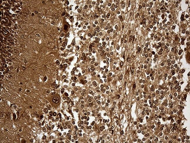 KPNB1 Antibody in Immunohistochemistry (Paraffin) (IHC (P))