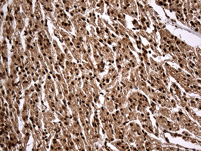 KPNB1 Antibody in Immunohistochemistry (Paraffin) (IHC (P))