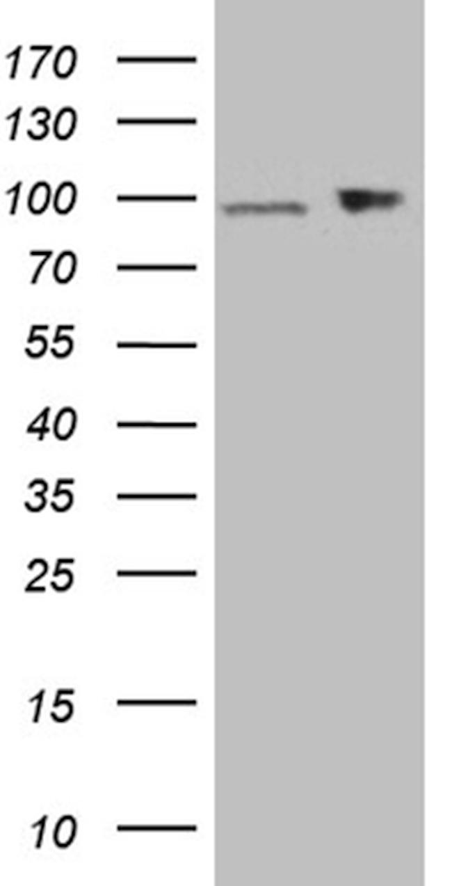 KPNB1 Antibody in Western Blot (WB)