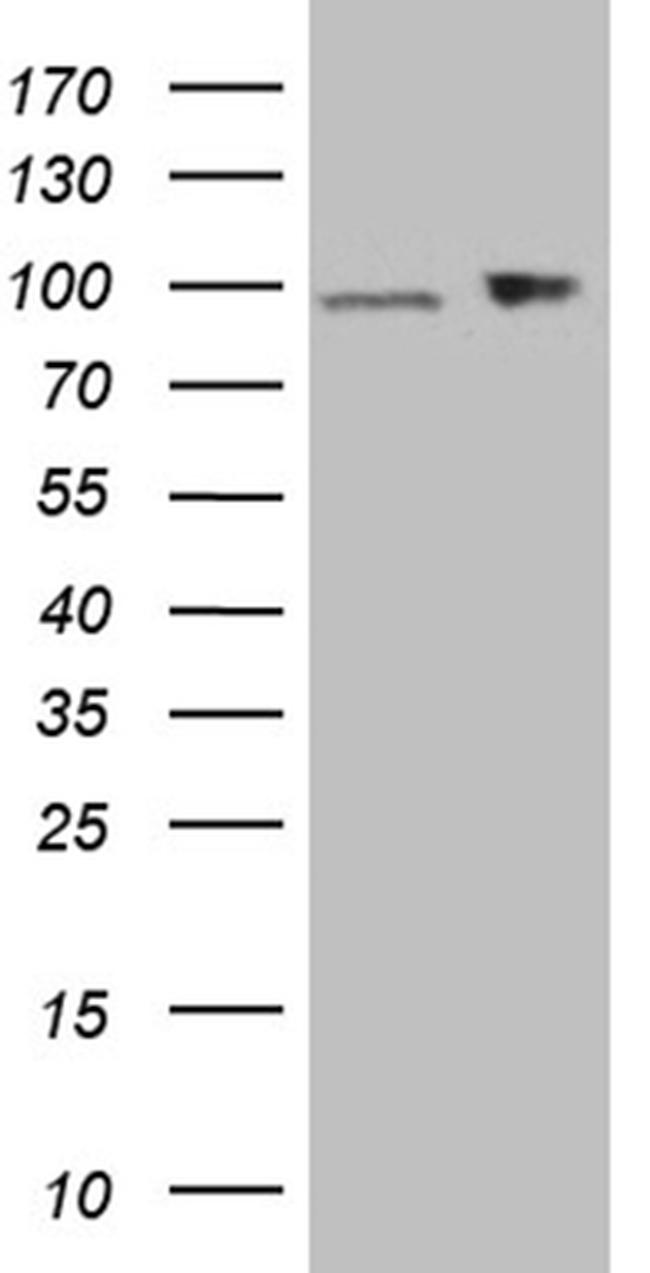 KPNB1 Antibody in Western Blot (WB)