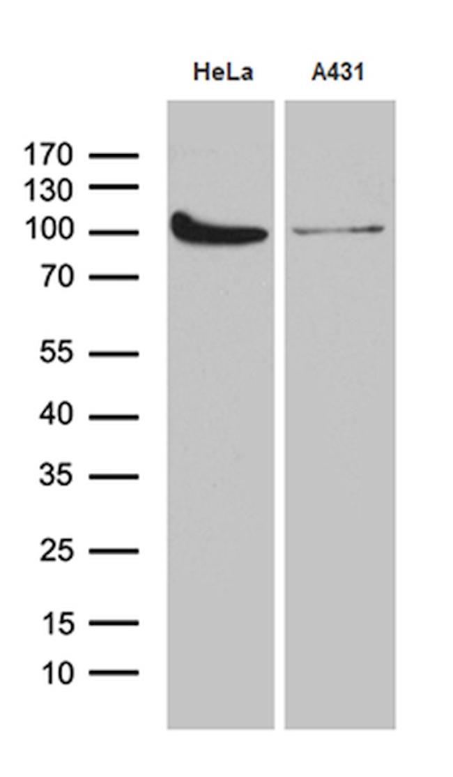 KPNB1 Antibody in Western Blot (WB)