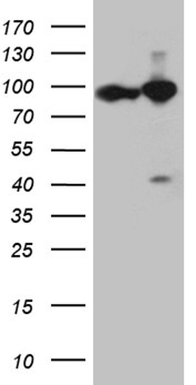 KPNB1 Antibody in Western Blot (WB)