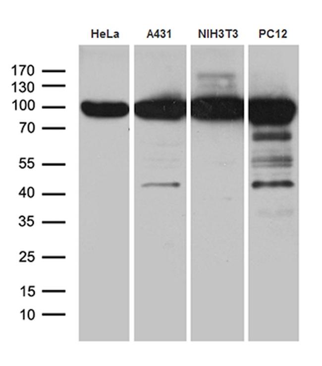 KPNB1 Antibody in Western Blot (WB)