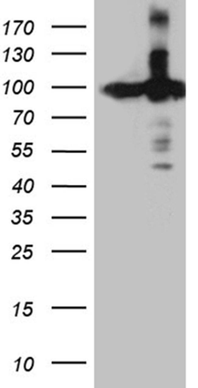 KPNB1 Antibody in Western Blot (WB)