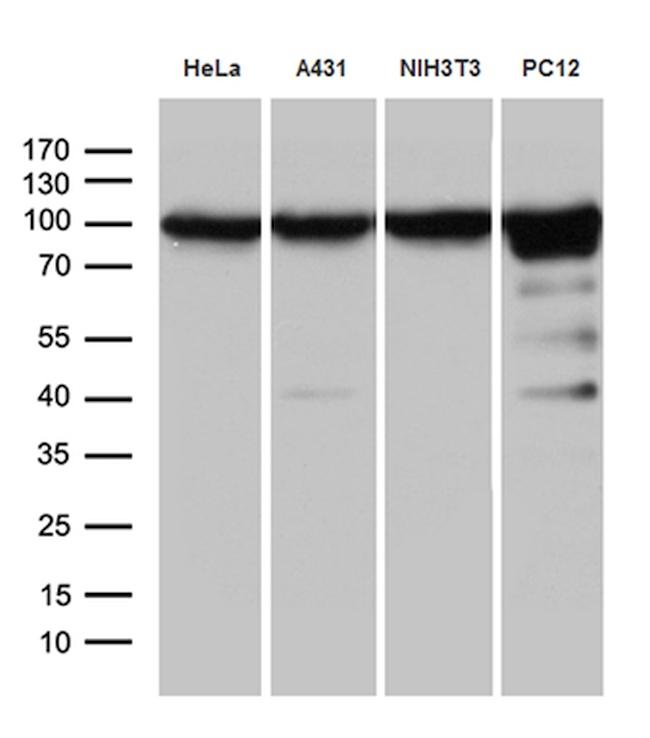 KPNB1 Antibody in Western Blot (WB)