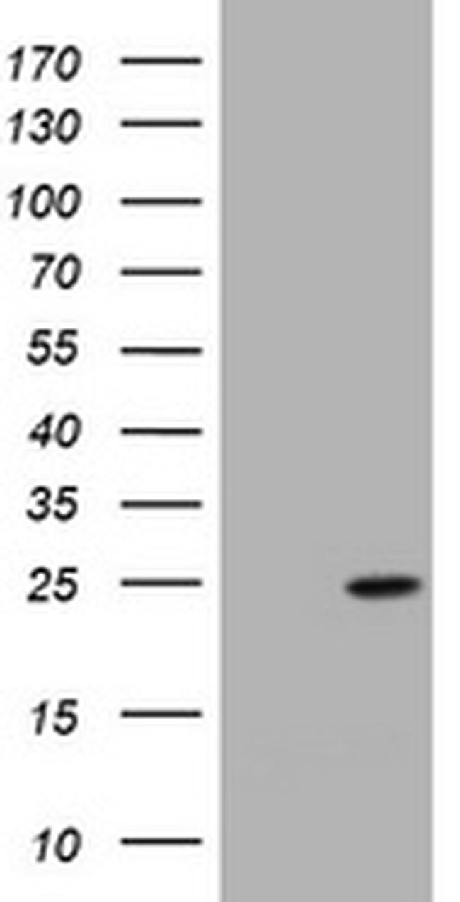 KRAS Antibody in Western Blot (WB)